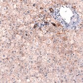 Monoclonal Anti-CLDN1 antibody produced in mouse Prestige Antibodies&#174; Powered by Atlas Antibodies, clone CL3698, purified immunoglobulin, buffered aqueous glycerol solution