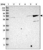 Anti-KLHL26 antibody produced in rabbit Prestige Antibodies&#174; Powered by Atlas Antibodies, affinity isolated antibody, buffered aqueous glycerol solution