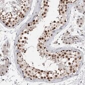 Anti-POLD2 antibody produced in rabbit Prestige Antibodies&#174; Powered by Atlas Antibodies, affinity isolated antibody, buffered aqueous glycerol solution
