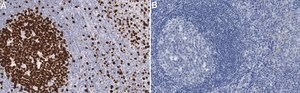 Anti-Ki-67 Antibody, clone Ki-S5 ZooMAb&#174; Mouse Monoclonal recombinant, expressed in HEK 293 cells