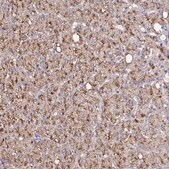 Anti-CAT antibody produced in rabbit Prestige Antibodies&#174; Powered by Atlas Antibodies, affinity isolated antibody, buffered aqueous glycerol solution
