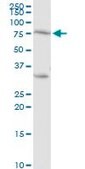 Anti-PRKCH antibody produced in rabbit purified immunoglobulin, buffered aqueous solution