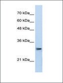Anti-PSMA1 antibody produced in rabbit affinity isolated antibody