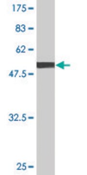 Monoclonal Anti-GSTT1 antibody produced in mouse clone 2D12-1C9, purified immunoglobulin, buffered aqueous solution