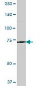 Anti-GLB1 antibody produced in mouse purified immunoglobulin, buffered aqueous solution