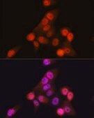 Anti- CDKN2A/p16INK4a antibody produced in rabbit