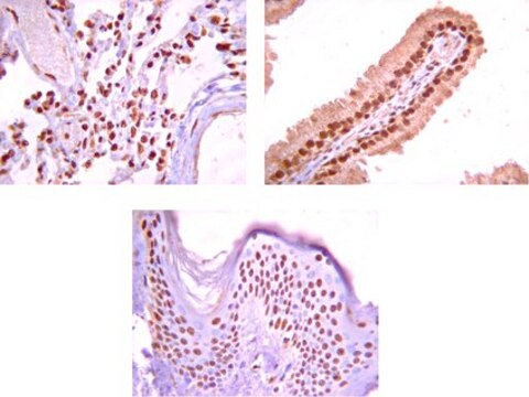 Anti-Na+/K+ ATPase &#945;-1 Antibody Upstate&#174;, from rabbit