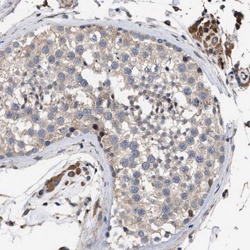 Anti-SQLE antibody produced in rabbit Prestige Antibodies&#174; Powered by Atlas Antibodies, affinity isolated antibody, buffered aqueous glycerol solution