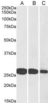 Anti-SNAP25 antibody produced in goat affinity isolated antibody, buffered aqueous solution