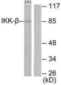 Anti-IKK-&#946; antibody produced in rabbit affinity isolated antibody