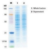 cOmplete&#8482; Lysis-M storage temp.:room temp