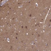 Anti-PRKCE antibody produced in rabbit Prestige Antibodies&#174; Powered by Atlas Antibodies, affinity isolated antibody, buffered aqueous glycerol solution
