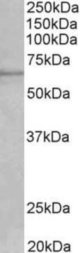 Anti-IKZF1 antibody produced in goat affinity isolated antibody, buffered aqueous solution