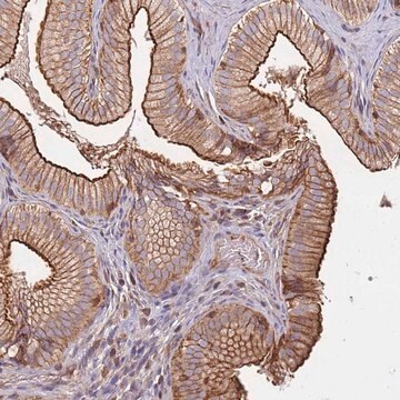 Anti-CYP2U1 antibody produced in rabbit Prestige Antibodies&#174; Powered by Atlas Antibodies, affinity isolated antibody, buffered aqueous glycerol solution