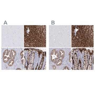 Anti-UGDH antibody produced in rabbit Prestige Antibodies&#174; Powered by Atlas Antibodies, affinity isolated antibody, buffered aqueous glycerol solution