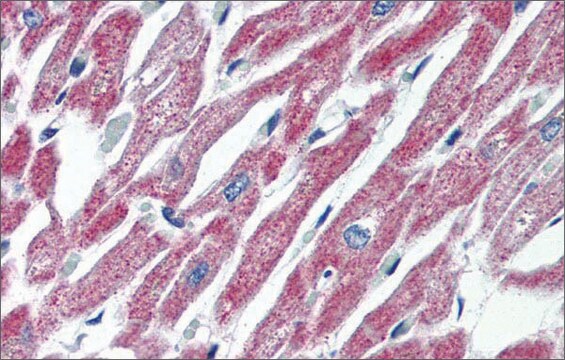 Anti-MAS1 (AB1) antibody produced in rabbit affinity isolated antibody