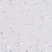 Anti-FGB antibody produced in rabbit Ab2, Prestige Antibodies&#174; Powered by Atlas Antibodies, affinity isolated antibody, buffered aqueous glycerol solution