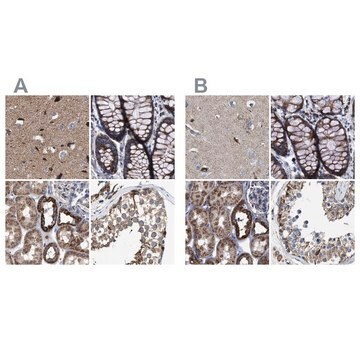 Anti-MECR antibody produced in rabbit Prestige Antibodies&#174; Powered by Atlas Antibodies, affinity isolated antibody, buffered aqueous glycerol solution, Ab1