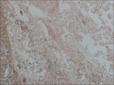 Monoclonal Anti-Proliferating Cell Nuclear Antigen antibody produced in mouse clone PC 10, ascites fluid