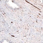 Monoclonal Anti-TUBB3 antibody produced in mouse Prestige Antibodies&#174; Powered by Atlas Antibodies, clone CL5814, purified immunoglobulin, buffered aqueous glycerol solution