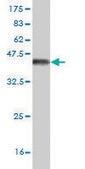 Monoclonal Anti-CACNB1 antibody produced in mouse clone 1G6, purified immunoglobulin, buffered aqueous solution
