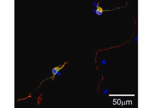 Milli-Mark&#174; ChromaPan Neuronal Marker-ORC Milli-Mark ChromaPan Neuronal Marker-ORC is an antibody targeting the ORC protein, validated for use in ICC &amp; IF.