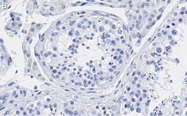Anti-p14ARF Antibody, clone 4F19 ZooMAb&#174; Rabbit Monoclonal recombinant, expressed in HEK 293 cells