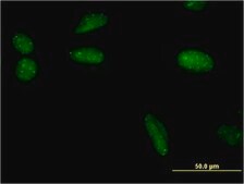 Monoclonal Anti-SUMO1 antibody produced in mouse clone 3D7, purified immunoglobulin, buffered aqueous solution