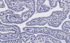 Anti-TYK2 Antibody, clone 2H22 ZooMAb&#174; Rabbit Monoclonal recombinant, expressed in HEK 293 cells