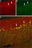 Anti-Sodium Channel, Pan antibody produced in rabbit affinity isolated antibody, lyophilized powder