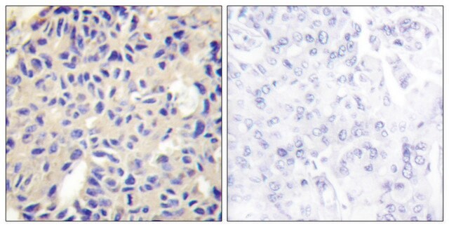 Anti-Collagen V &#945;2 antibody produced in rabbit affinity isolated antibody