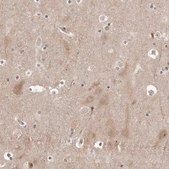 Anti-PTK2B antibody produced in rabbit Prestige Antibodies&#174; Powered by Atlas Antibodies, affinity isolated antibody, buffered aqueous glycerol solution, ab2