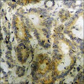 Anti-phospho-PKD1/PKC mu (pTyr463) antibody produced in rabbit affinity isolated antibody