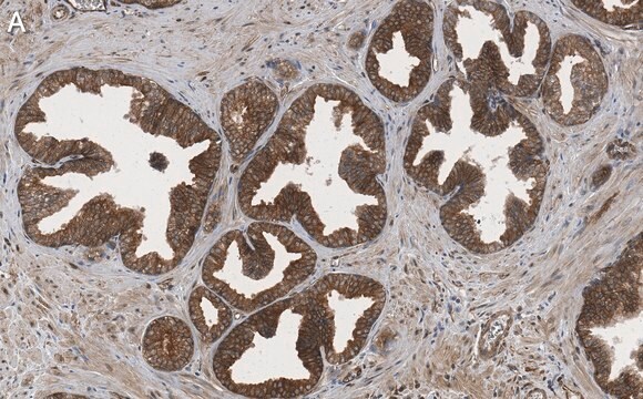 Anti-phospho-TSC2-Ser939 Antibody, clone 1G19 ZooMAb&#174; Rabbit Monoclonal recombinant, expressed in HEK 293 cells