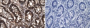 Anti- Galectin-3 Antibody, clone 1J2-H1 ZooMAb&#174; Rabbit Monoclonal recombinant, expressed in HEK 293 cells