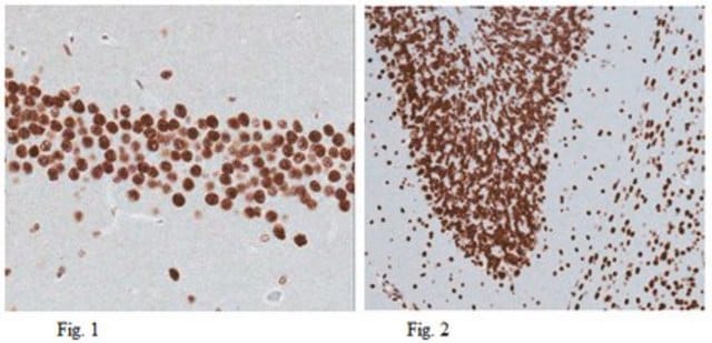 Anti-Sox11 Antibody from rabbit, purified by affinity chromatography