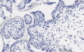 Anti-PDE4B Antibody, clone 1E9 ZooMAb&#174; Rabbit Monoclonal recombinant, expressed in HEK 293 cells