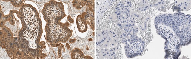 Anti-VEGF Receptor-3 Antibody, clone 9D9F9