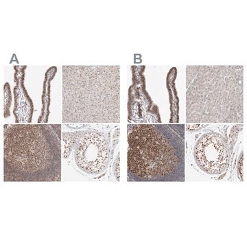 Anti-MSH6 antibody produced in rabbit Prestige Antibodies&#174; Powered by Atlas Antibodies, affinity isolated antibody, buffered aqueous glycerol solution, ab2