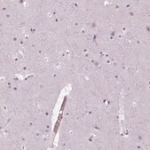 Anti-MKI67 antibody produced in rabbit Ab2, Prestige Antibodies&#174; Powered by Atlas Antibodies, affinity isolated antibody, buffered aqueous glycerol solution