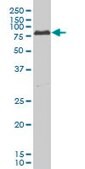 ANTI-PRKCI antibody produced in mouse clone 1C10, purified immunoglobulin, buffered aqueous solution