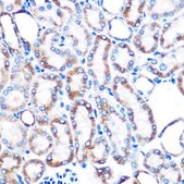 Anti-Lumican (LUM) antibody produced in rabbit