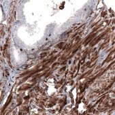 Monoclonal Anti-ZYX antibody produced in mouse Prestige Antibodies&#174; Powered by Atlas Antibodies, clone CL2502, purified immunoglobulin, buffered aqueous glycerol solution