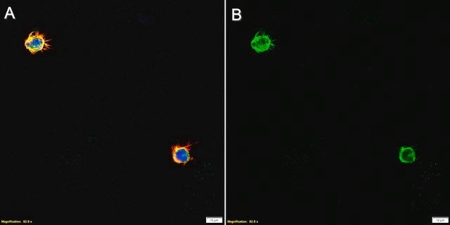 Anti-CD64 Antibody, clone 1B5 ZooMAb&#174; Rabbit Monoclonal recombinant, expressed in HEK 293 cells