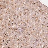 Anti-IGFBP1 antibody produced in rabbit Prestige Antibodies&#174; Powered by Atlas Antibodies, affinity isolated antibody, buffered aqueous glycerol solution