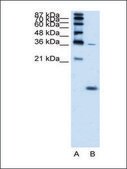 Anti-HBZ antibody produced in rabbit IgG fraction of antiserum