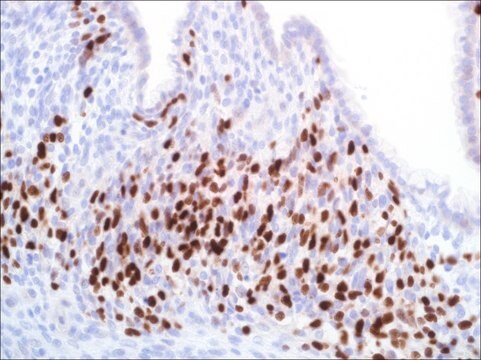 Myogenin (EP162) Rabbit Monoclonal Primary Antibody