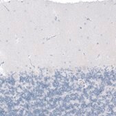 Anti-CFTR antibody produced in rabbit Prestige Antibodies&#174; Powered by Atlas Antibodies, affinity isolated antibody, buffered aqueous glycerol solution