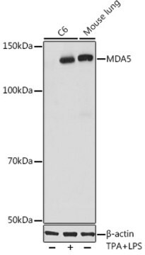 Anti-MDA5 Antibody, clone 2N8Z5, Rabbit Monoclonal