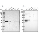 Anti-CASP6 antibody produced in rabbit Prestige Antibodies&#174; Powered by Atlas Antibodies, affinity isolated antibody, buffered aqueous glycerol solution